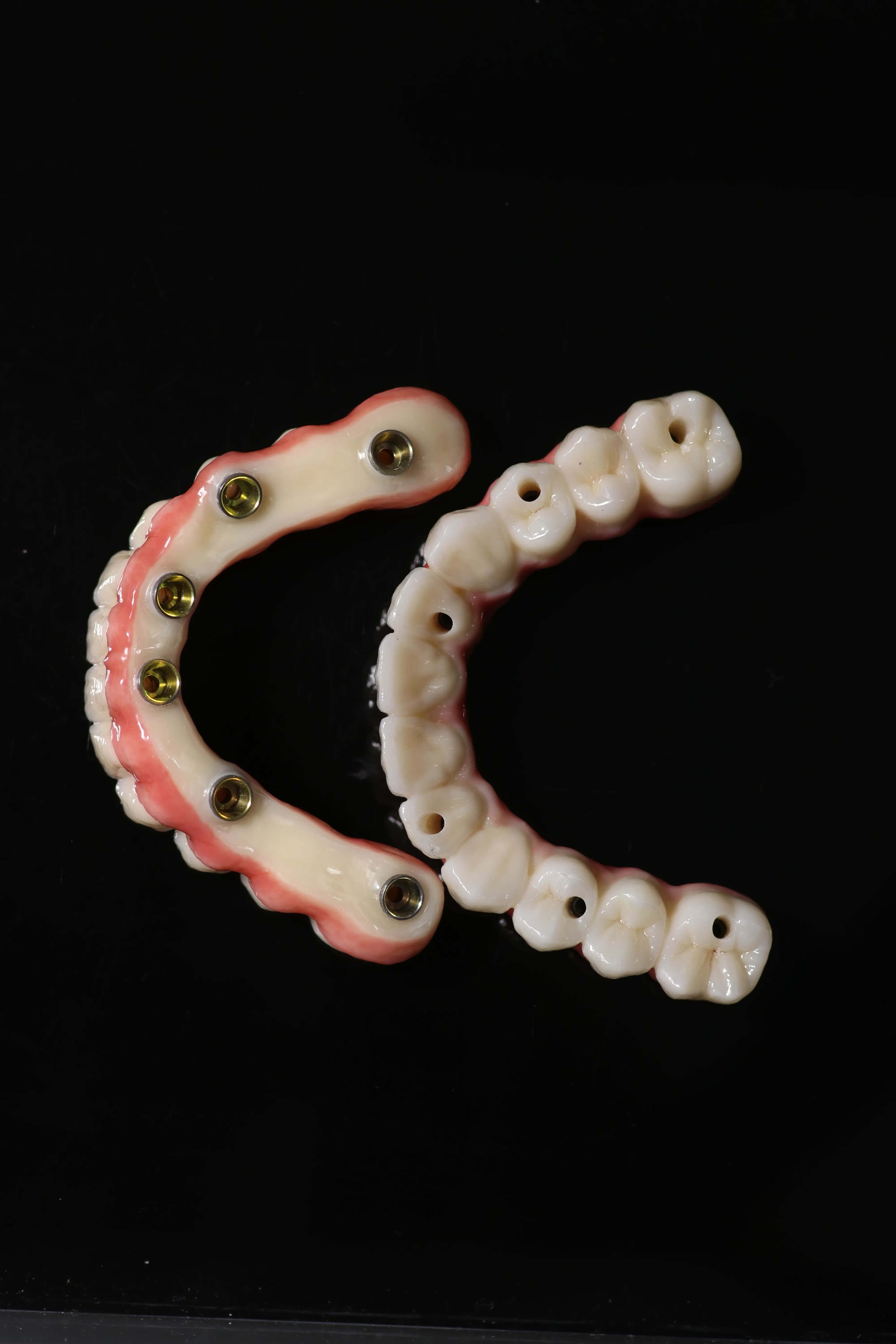 Cấy Ghép Implant