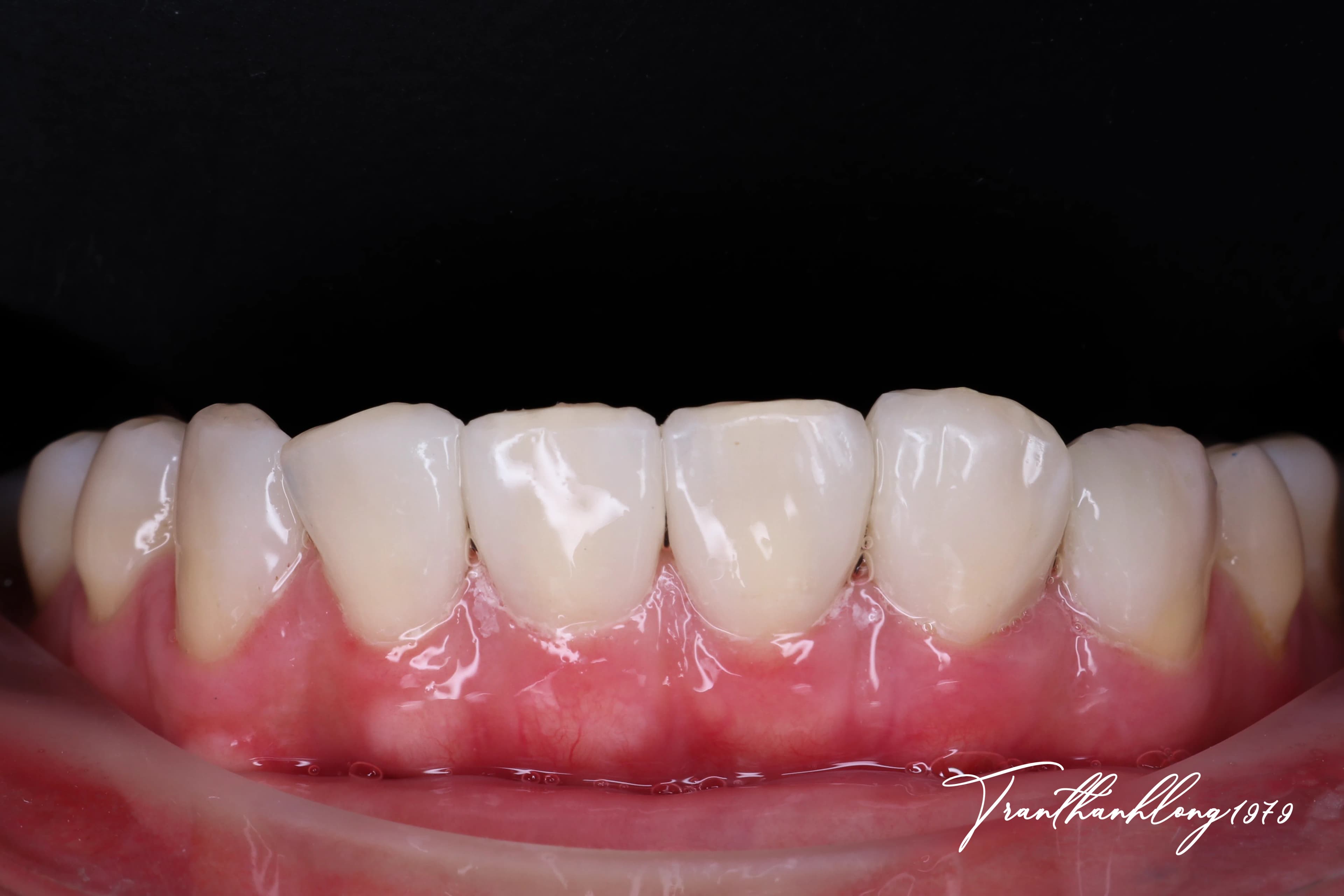 Kết quả điều trị của 002121224 - After