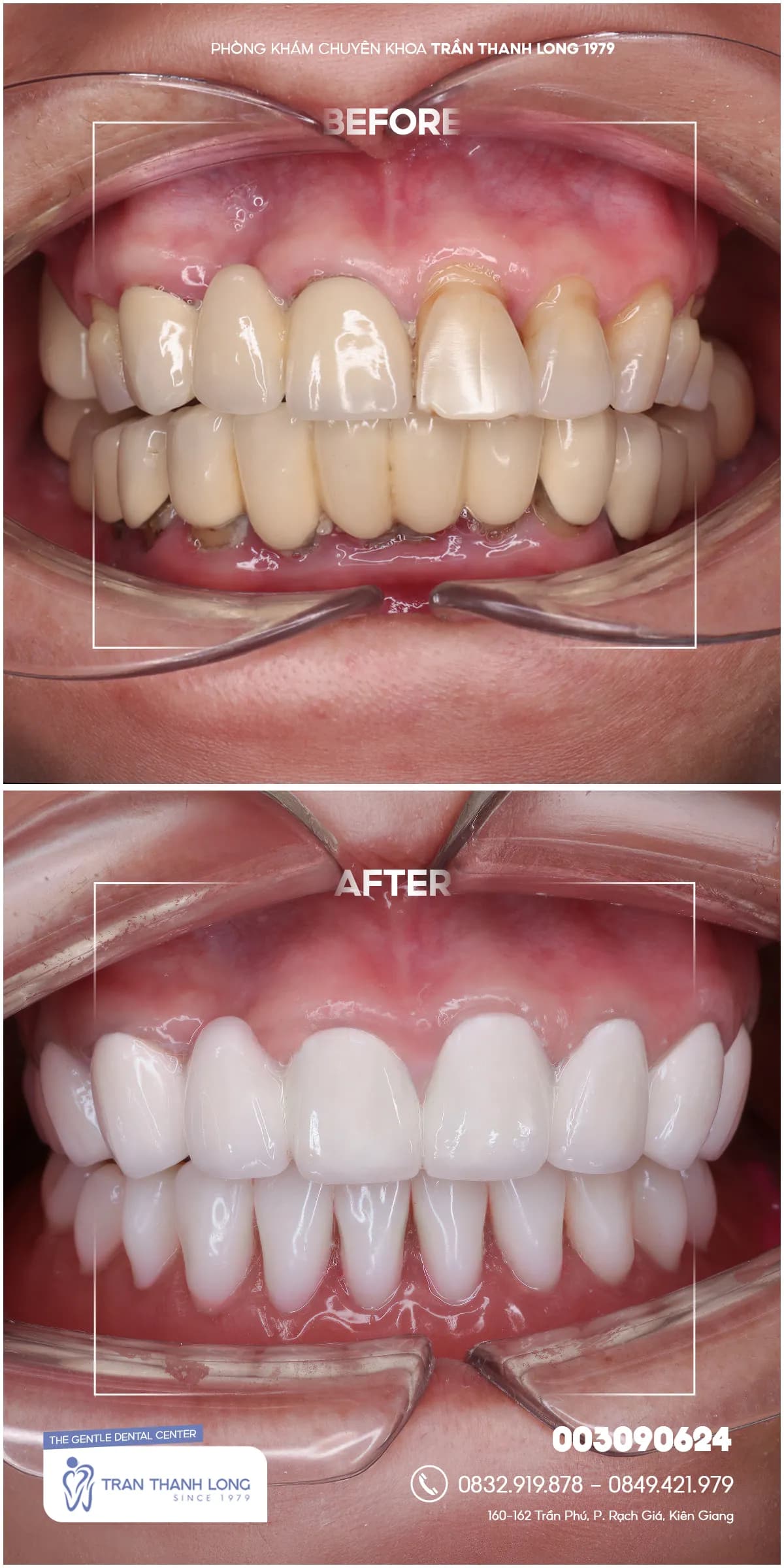 Hình ảnh quá trình điều trị 1