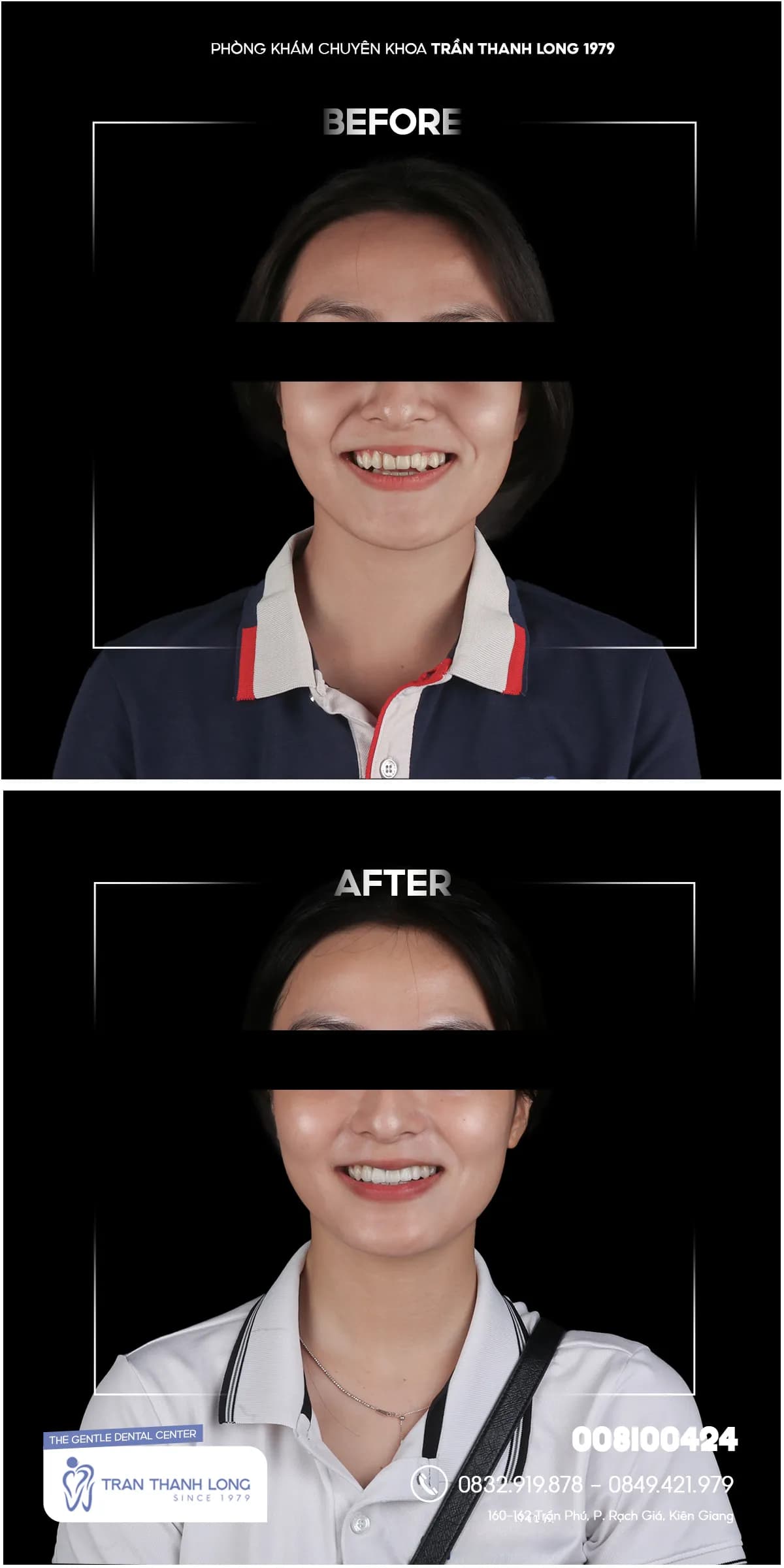 Hình ảnh quá trình điều trị 1