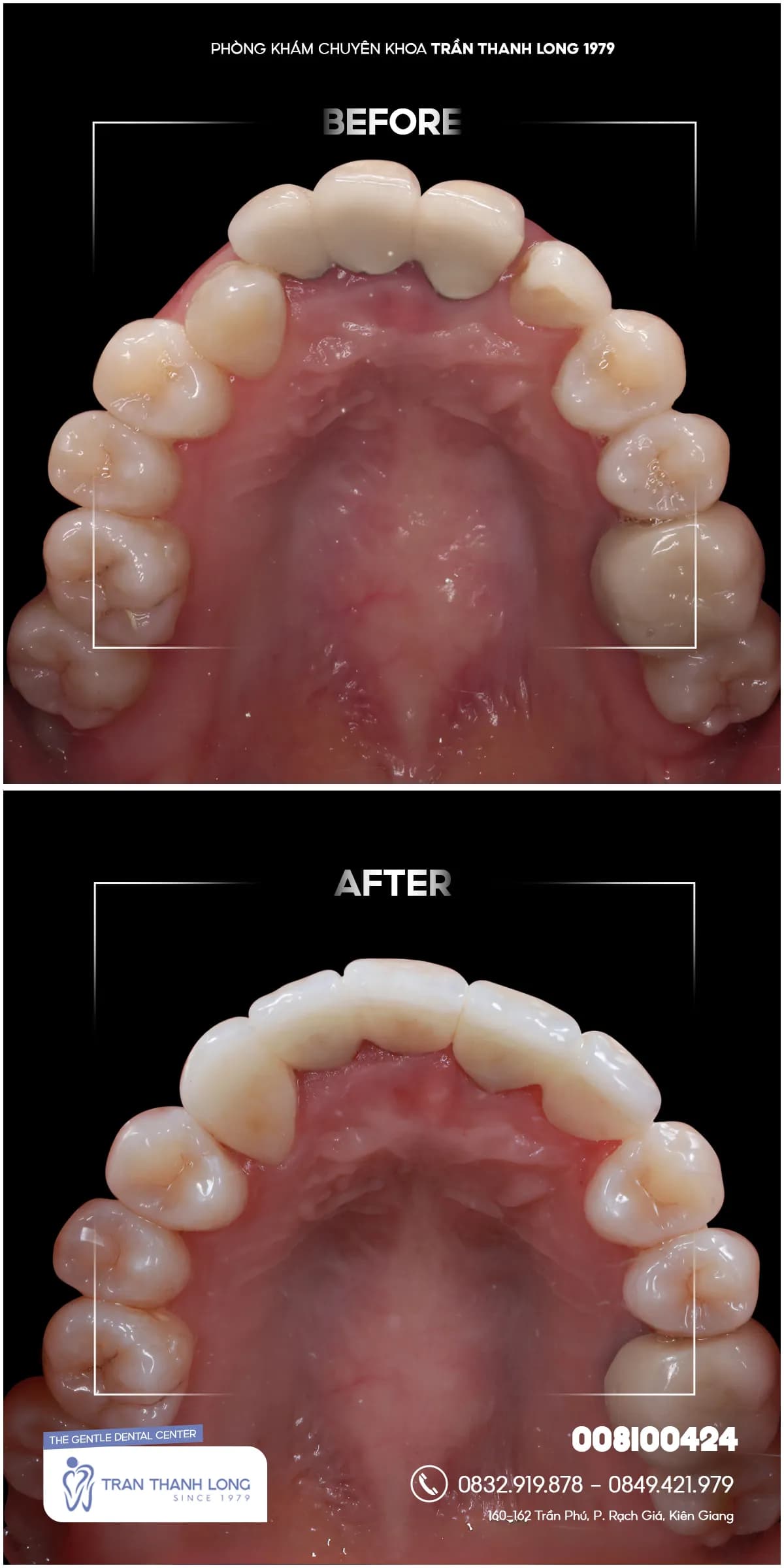 Hình ảnh quá trình điều trị 4
