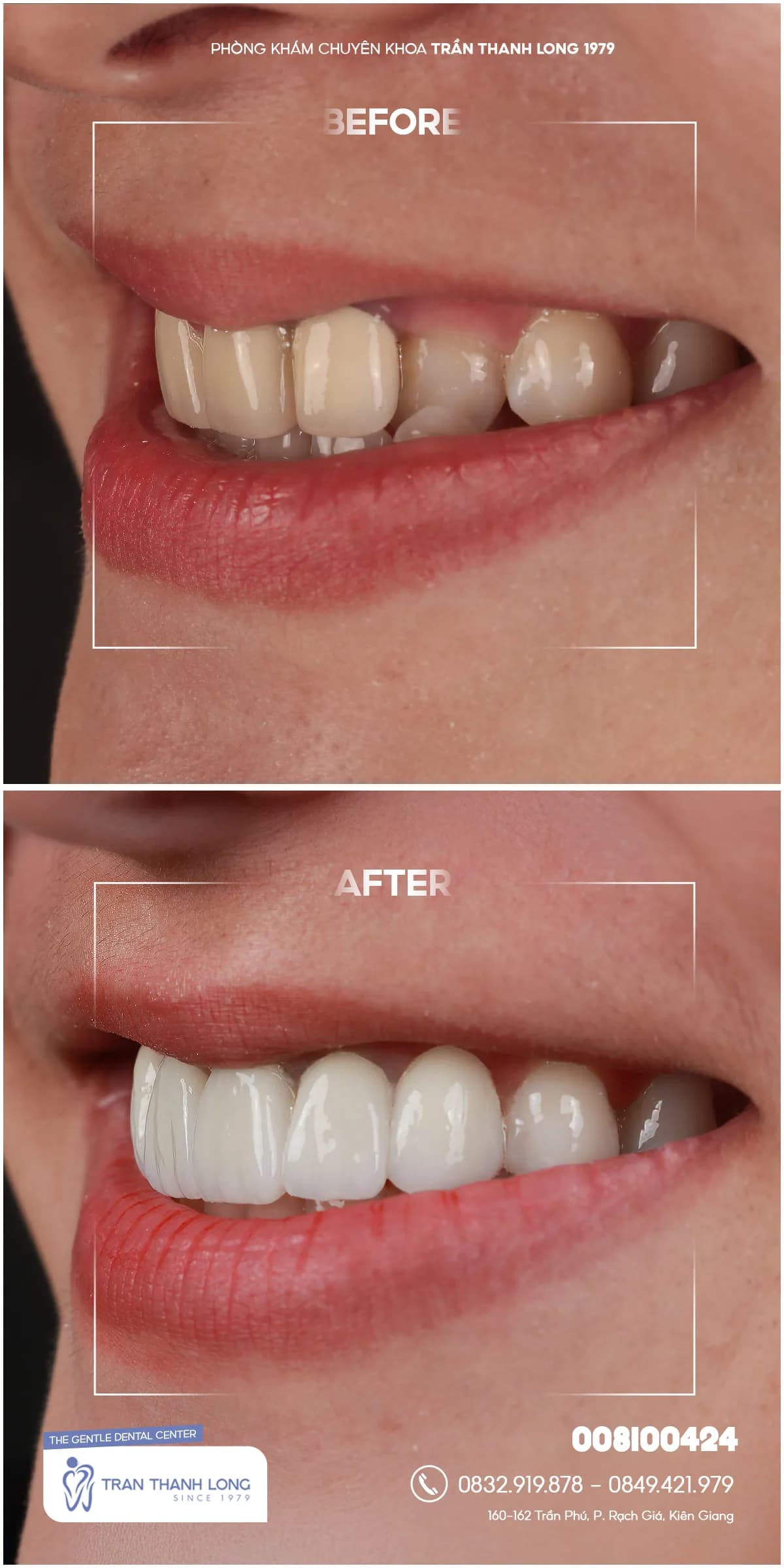 Hình ảnh quá trình điều trị 5