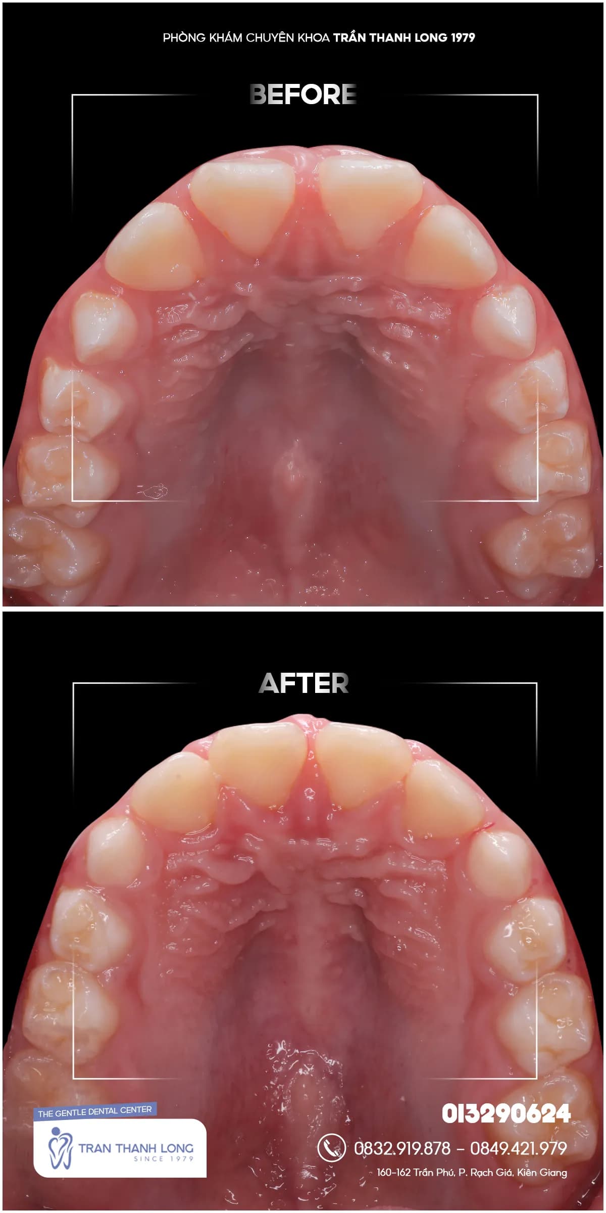 Hình ảnh quá trình điều trị 2