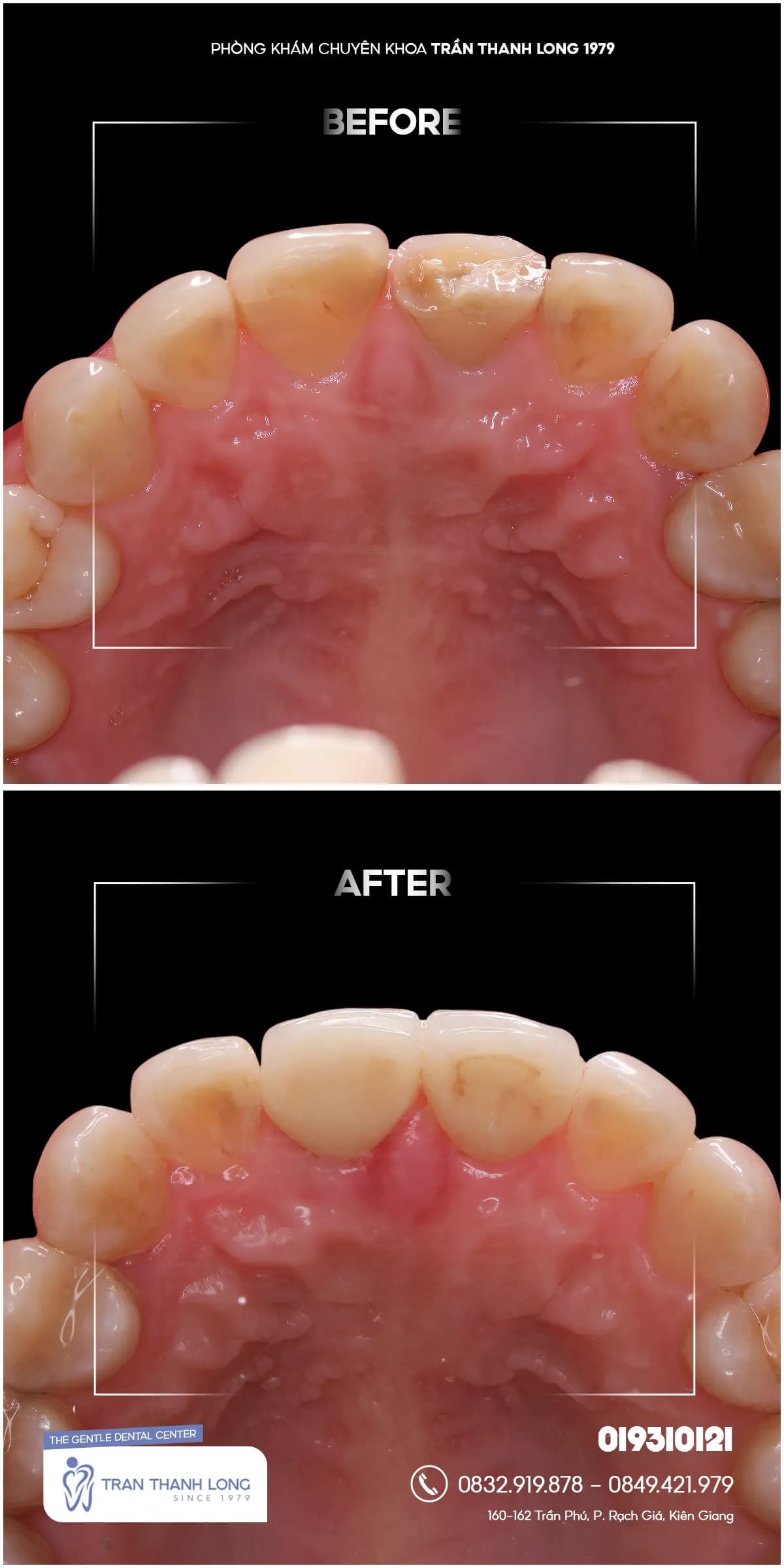 Hình ảnh quá trình điều trị 2