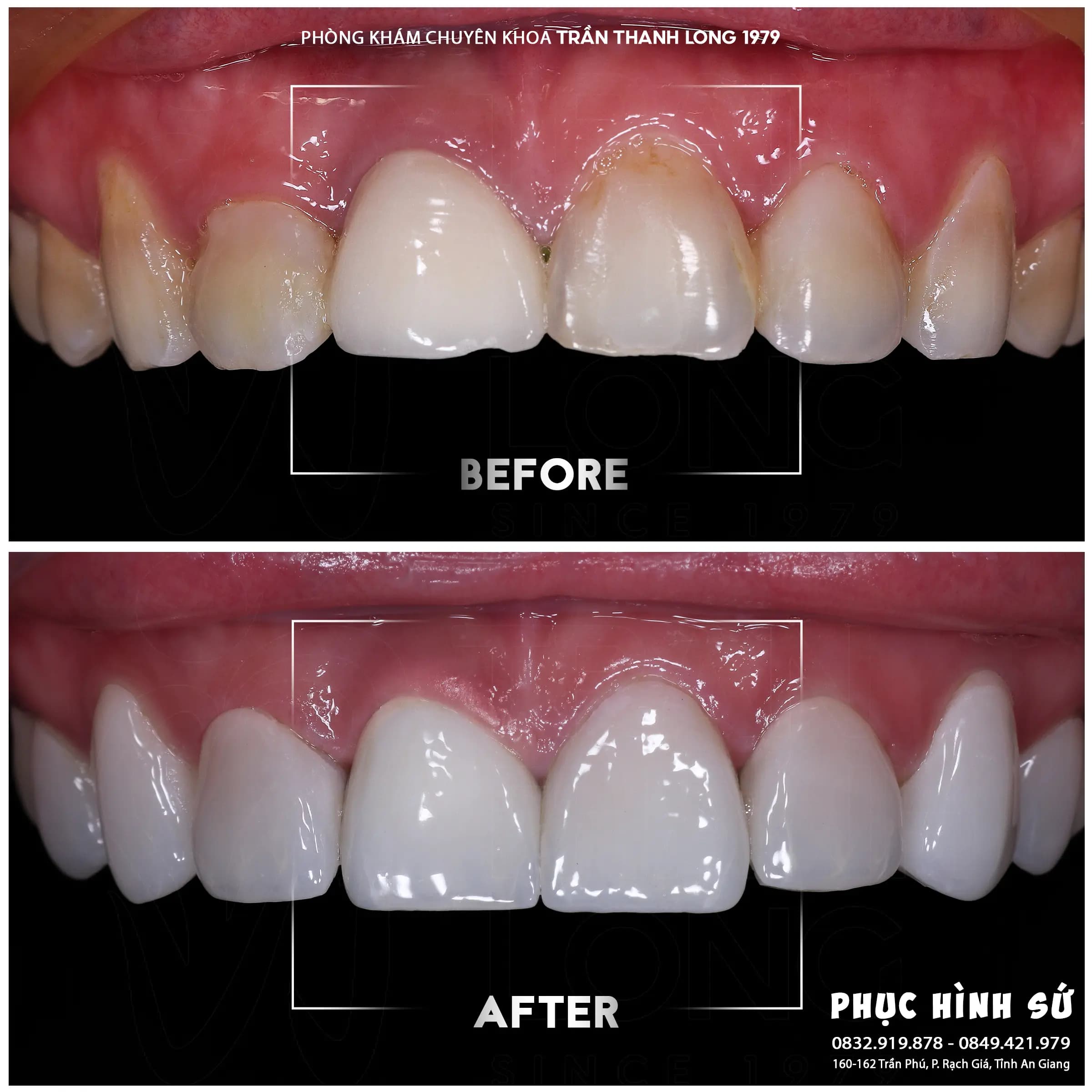 Hình ảnh quá trình điều trị 1