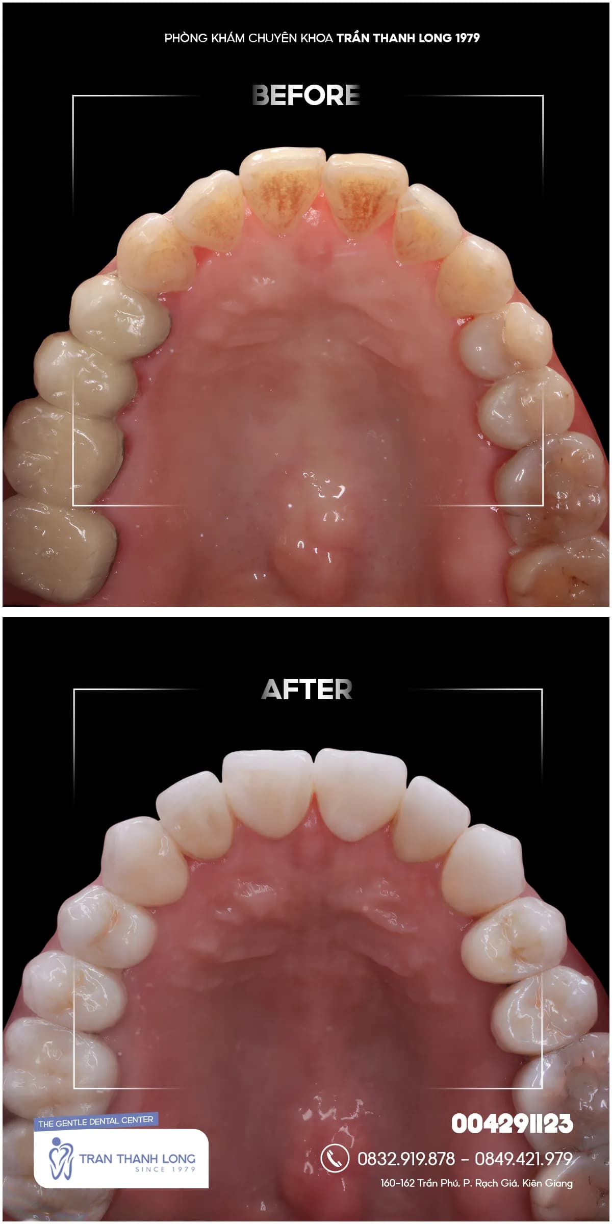 Hình ảnh quá trình điều trị 2
